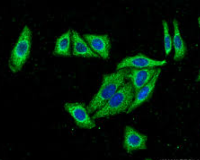 AKR7A2 Antibody