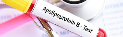 Apolipoprotein B Testing