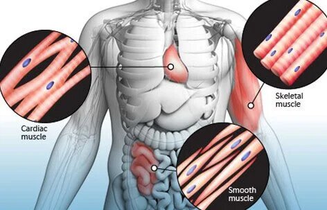 Becker Muscular Dystropy