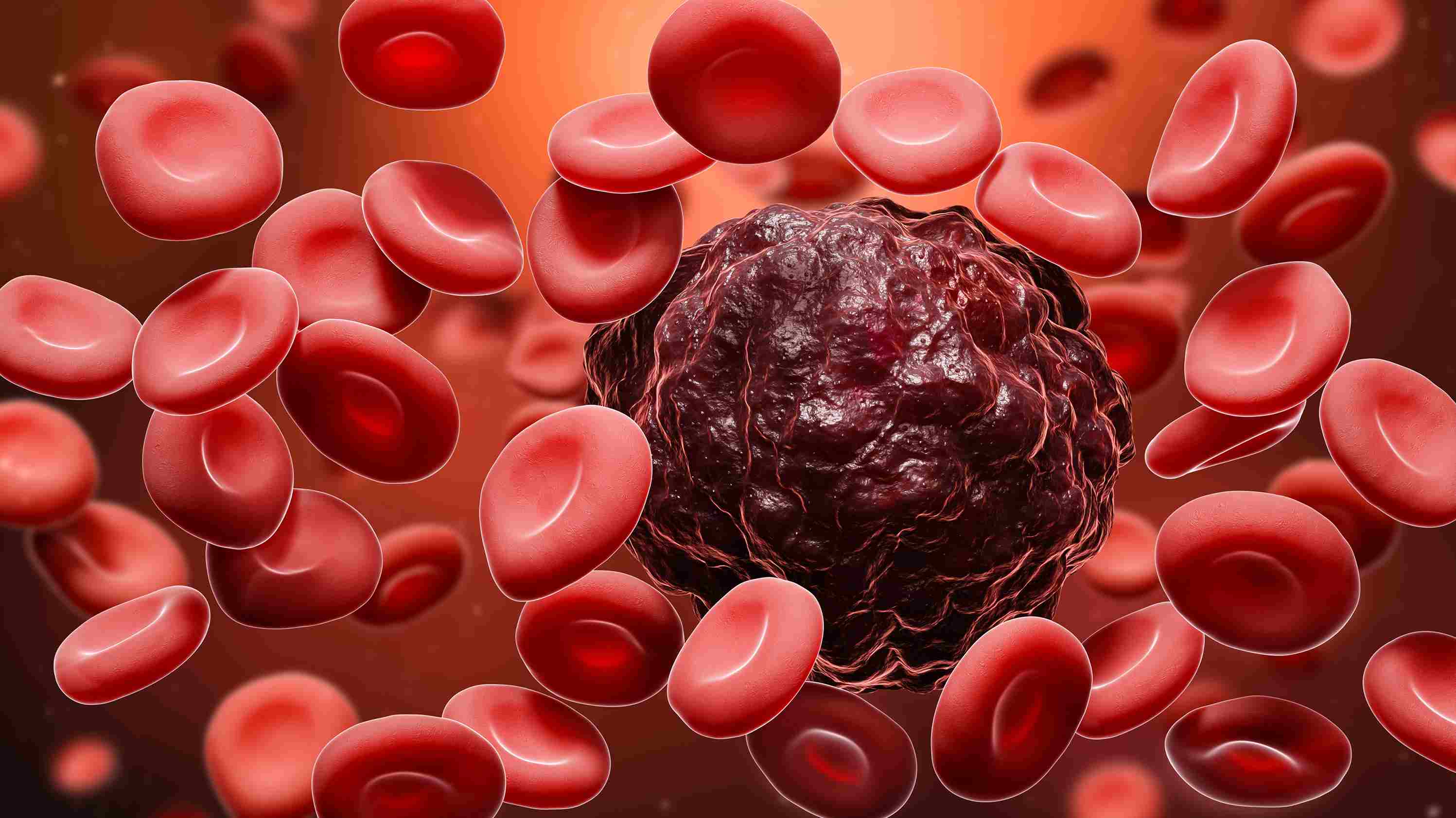 Blood Cancer Molecular Diagnostics