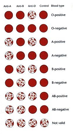 Blood Group Typing Technology