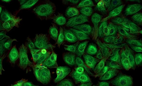 Total Internal Reflection Fluorescent Microscope