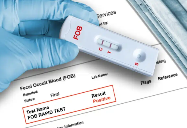 Fecal lmmunochemical Diagnostic Tests