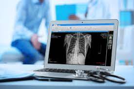 Computed Radiography and Digital Radiography