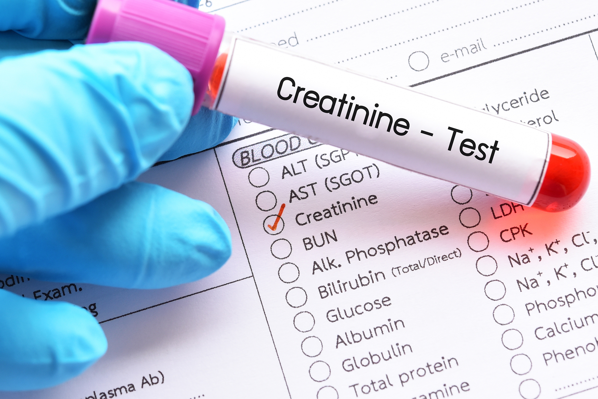 Creatinine Testing Service