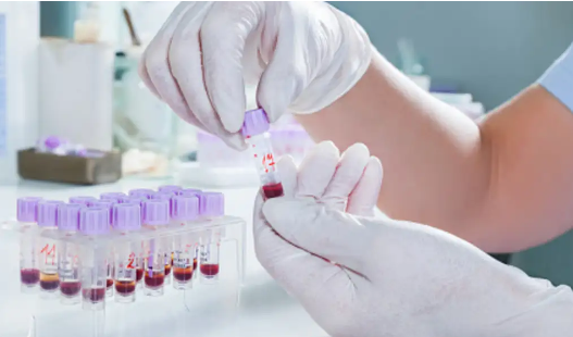 Diabetes Laboratory Immunoassays