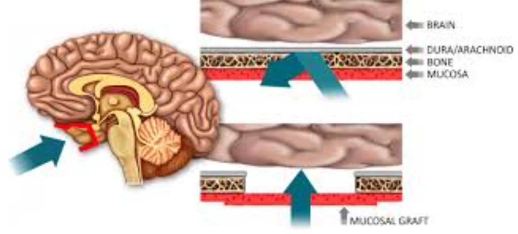 Drug Delivery Across Blood Brain Barrier