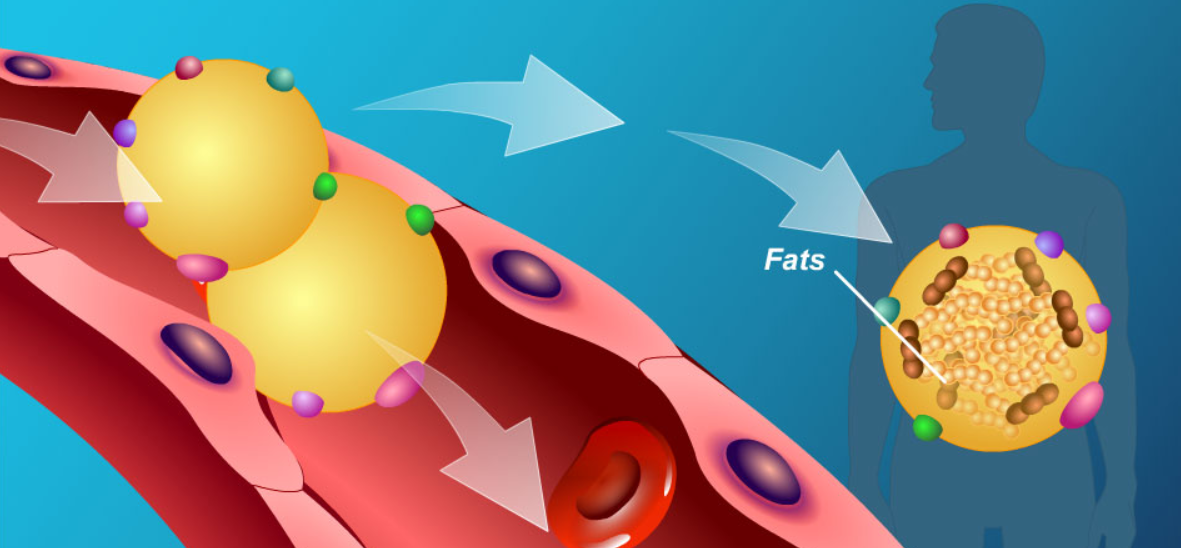 Familial Chylomicronemia Syndrome Therapeutics