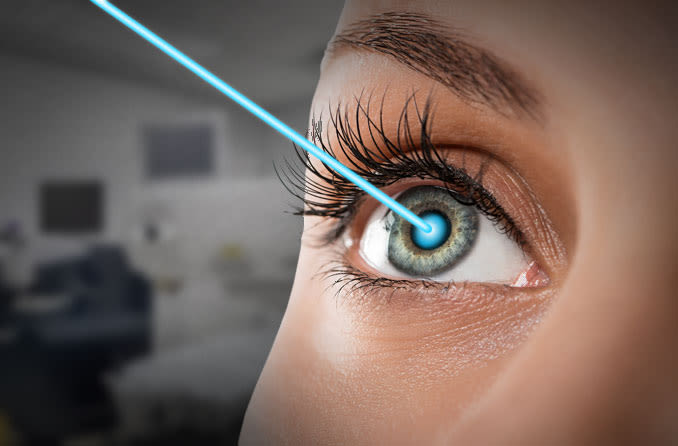 LASIK Treatment