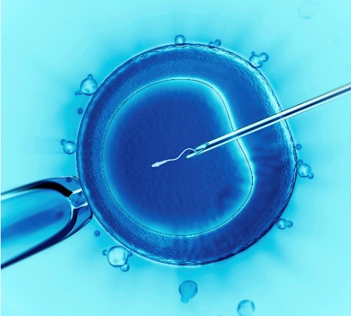 In-Vitro Fertilization