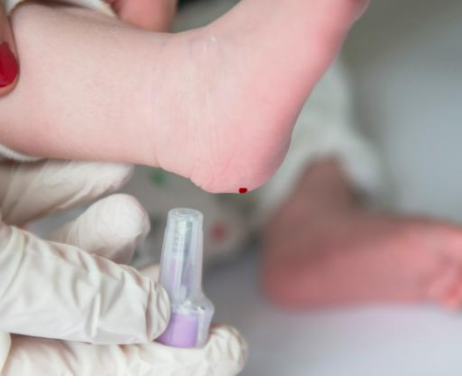 Newborn Blood Screening