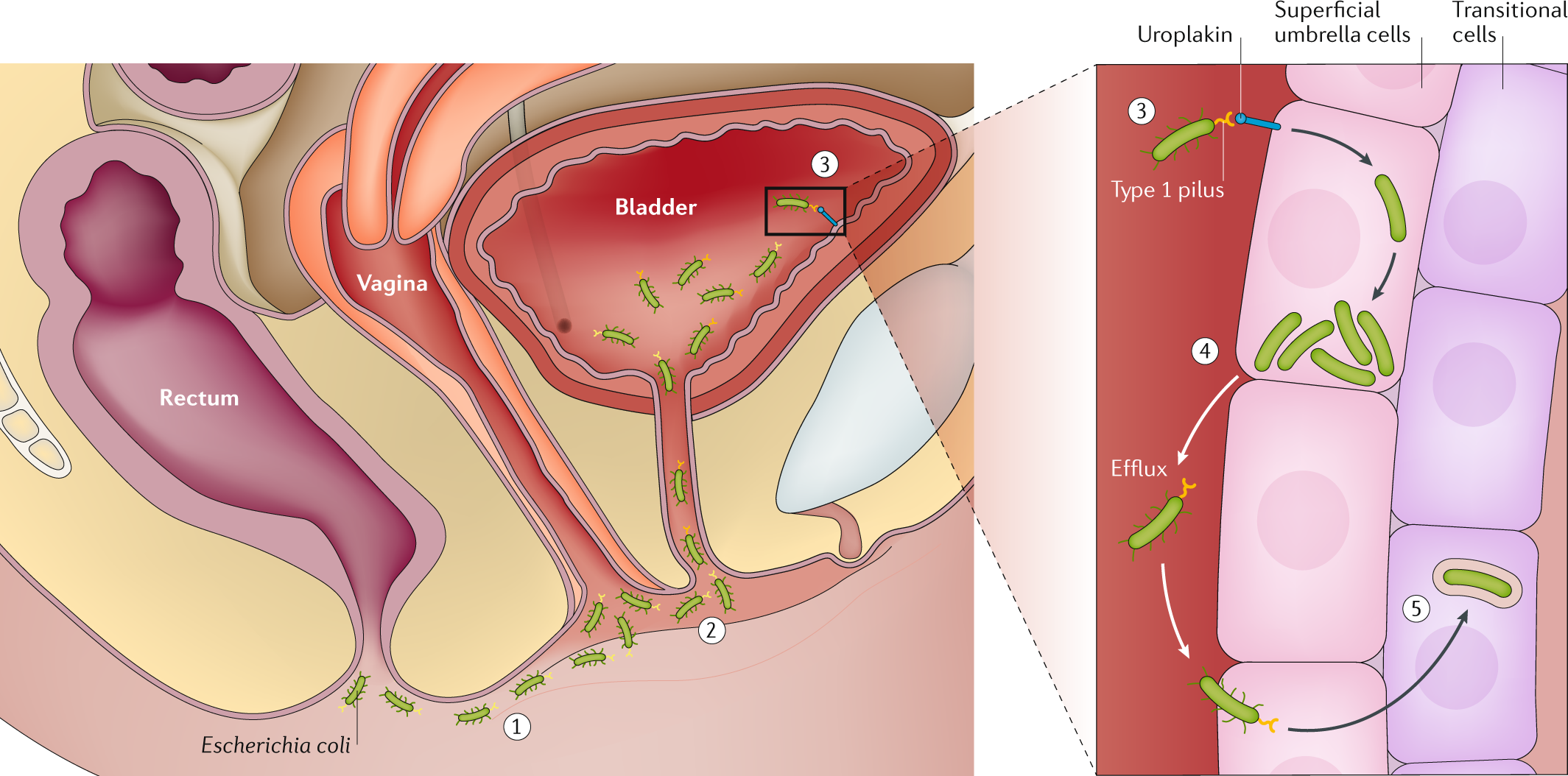 Self-urinary Infection Testing