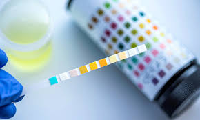 Substance Abuse Testing Services