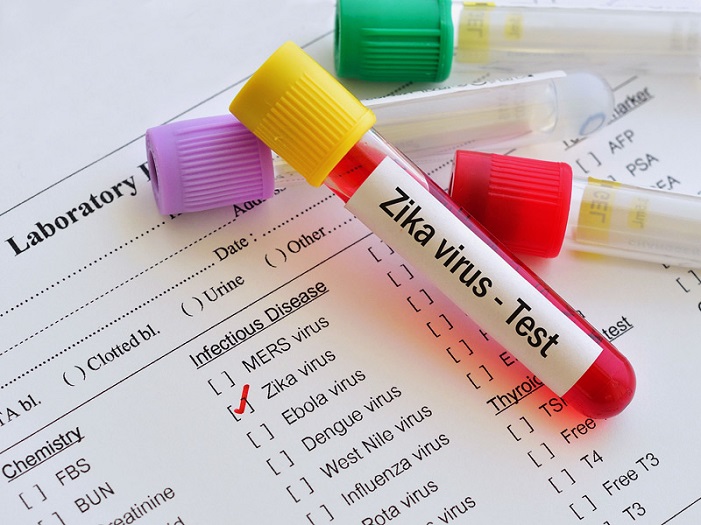 Zika Virus Testing