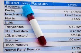 Lipid Panel Testing