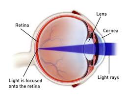 Refractive Vision Correction