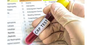 CRP Blood Test