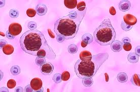 Primary Myelofibrosis Drug