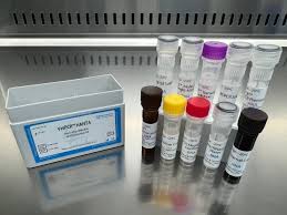 Hantavirus Nucleic Acid Detection Kit