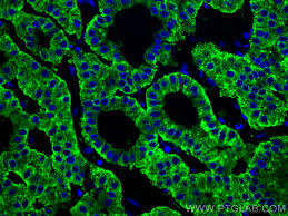 ASGR1 Antibody