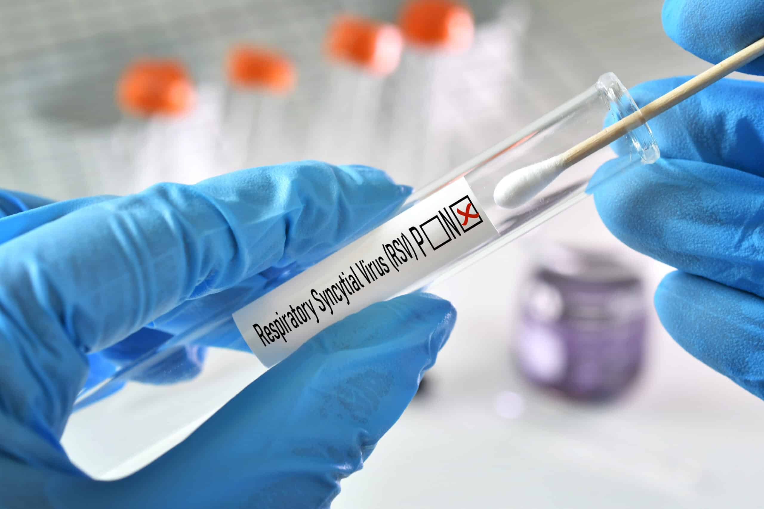 Respiratory Viruses Tests