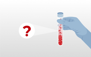 Erythrocyte Sedimentation Rate(ESR) Testing Service