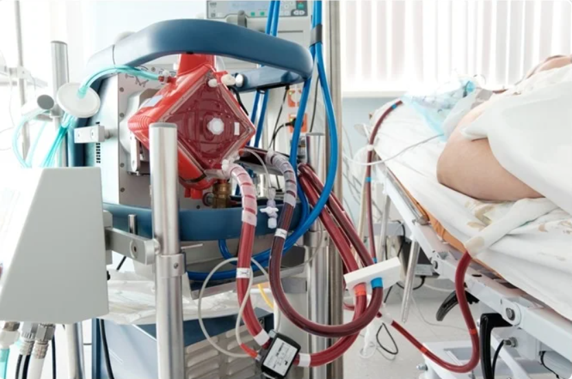 Extracorporeal Membrane Oxygenation Ecmo Cannula