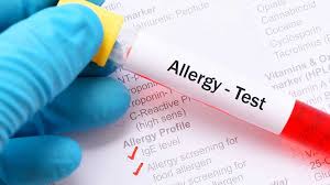 Food Allergen Testing