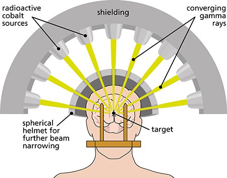 Gamma Knife