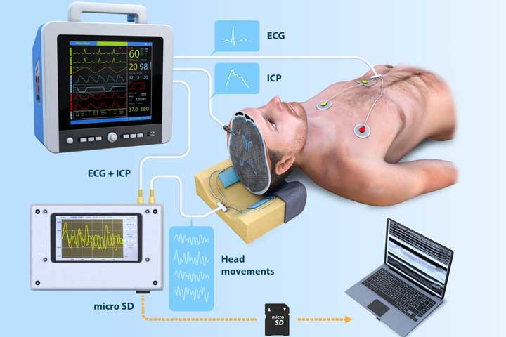 Intracranial Pressure Monitoring Device