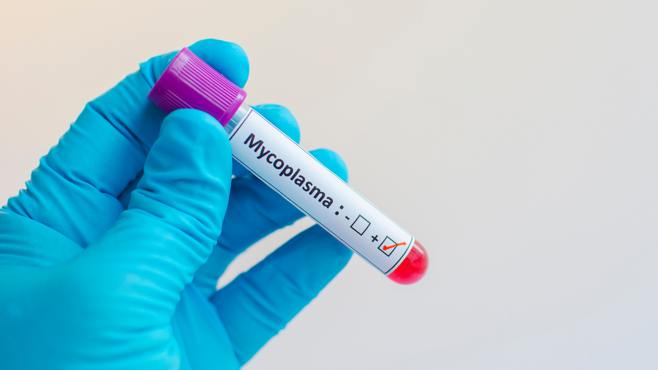 Mycoplasma Testing