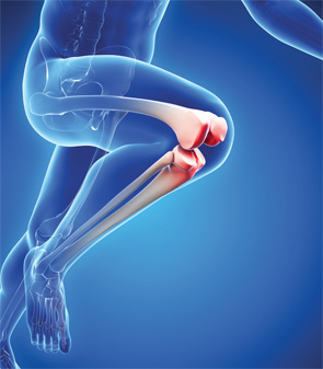 Osteoarthritis Therapeutics