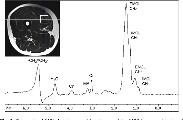 Proton Magnetic Resonance