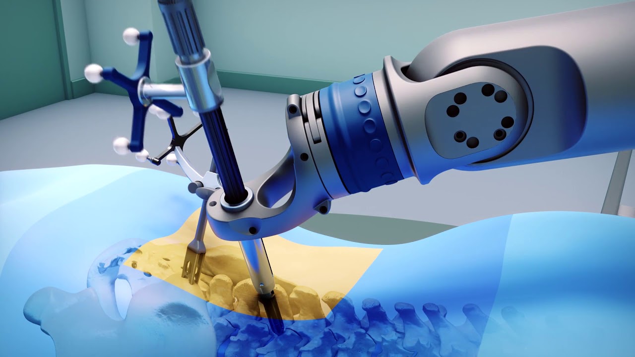 Orthopedic Surgical Robots