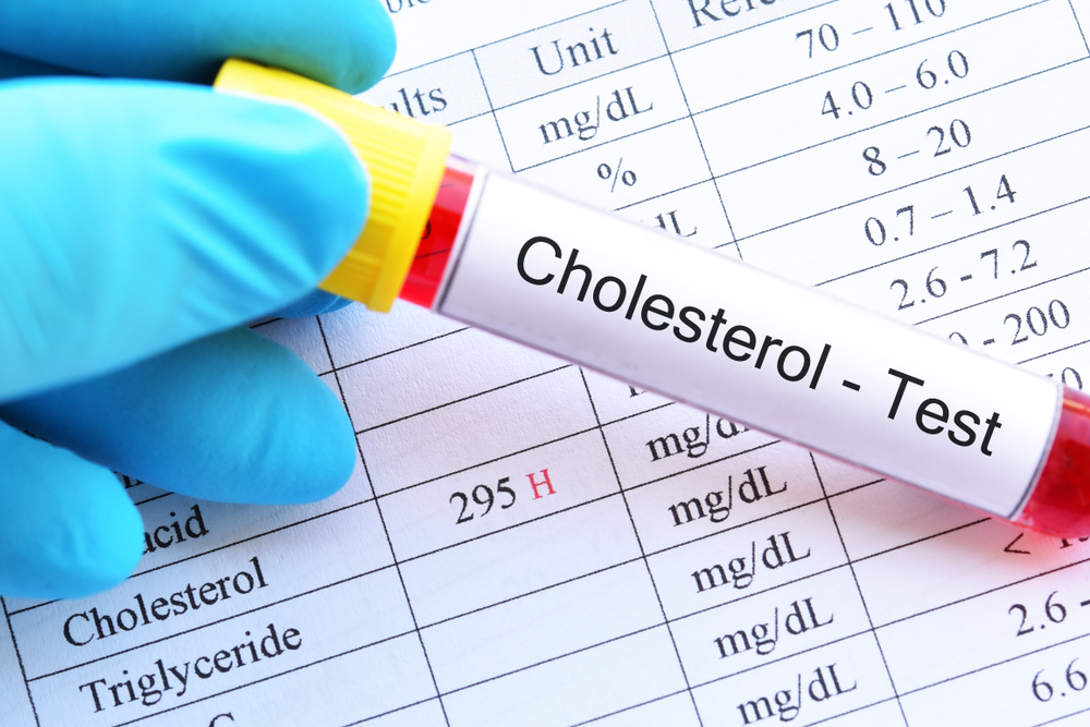 Cholesterol Testing