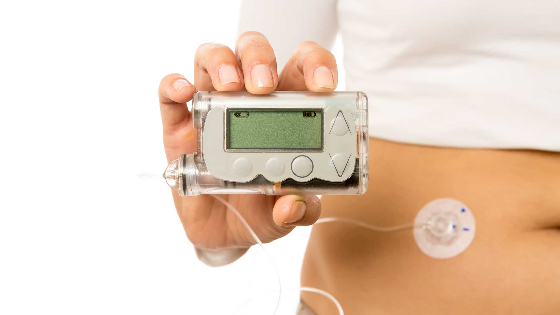 Insulin Pump