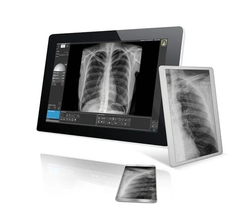 Medical Digital Radiography Detectors