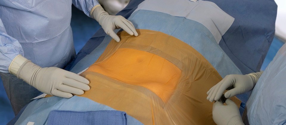 Surgical Incise Drape