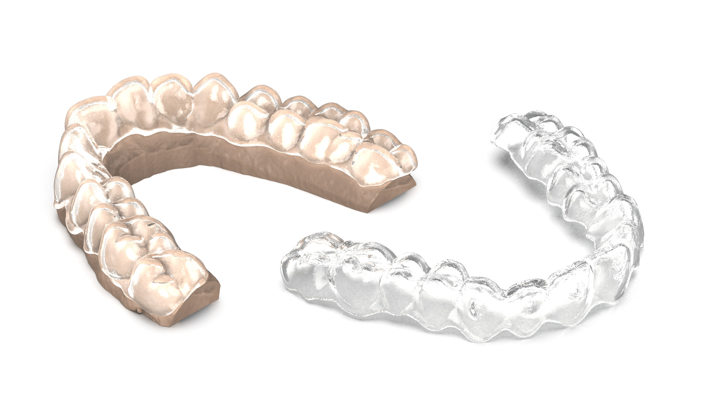 3D Printed Clear Dental Aligner