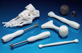 3D-Printed Orthopedic Implants