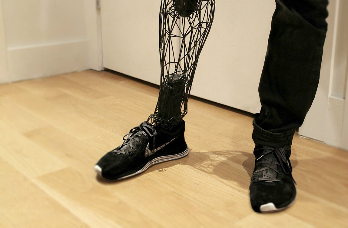 3D Printed Prosthetics Market