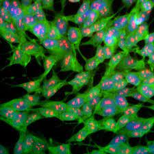 AFM Polyclonal Antibody market