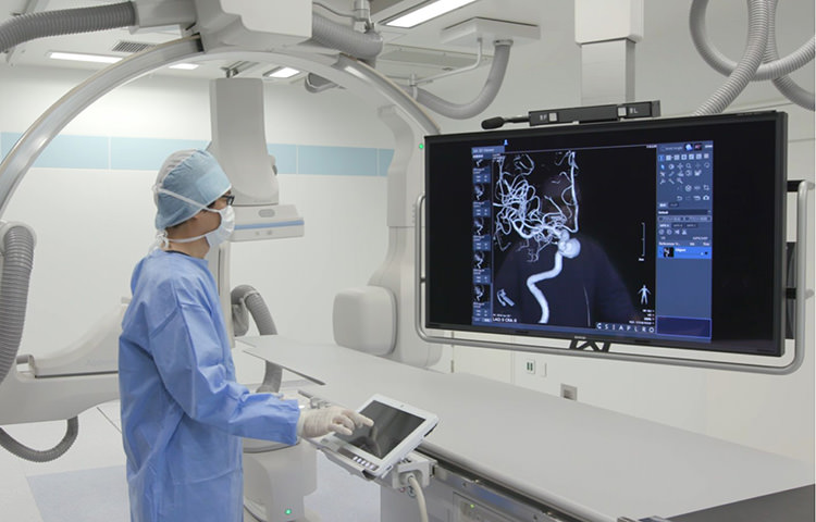 Angiography Devices