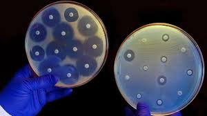 Antimicrobial Susceptibility Test Market