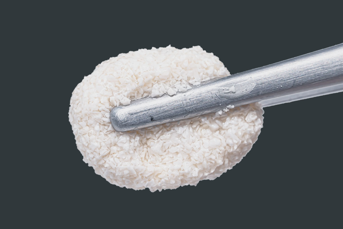 Bone Graft Substitute Material market