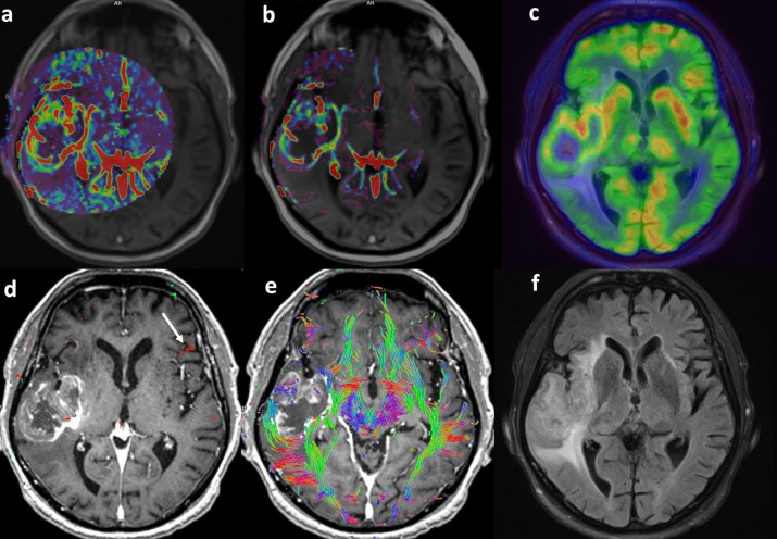 Brain PET-MRI Imaging Systems