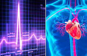 Cardiovascular Medical Devices