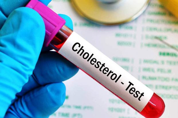 Cholesterol Screening & Cholesterol Lab Testing