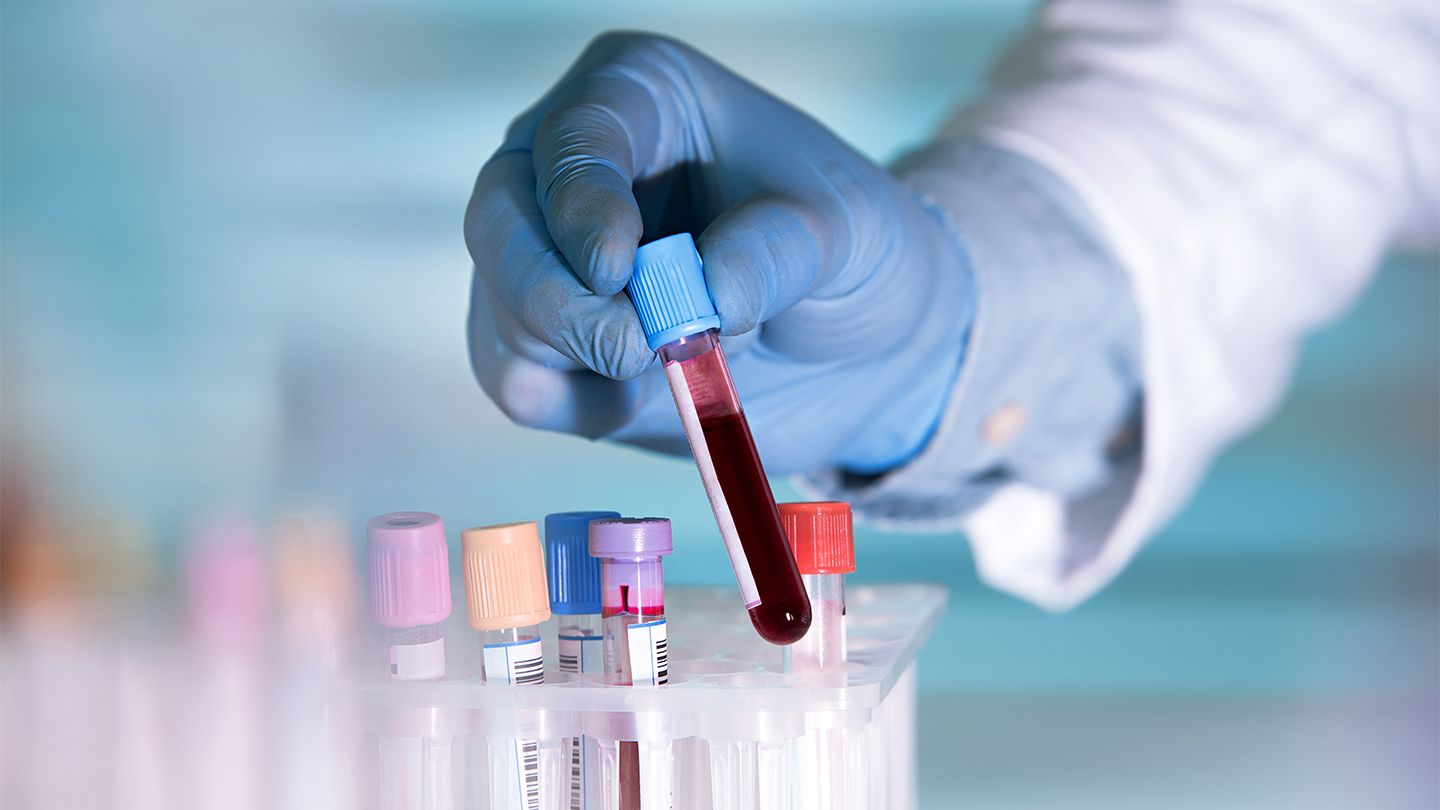 Circulating Tumor Cells (CTC) Liquid Biopsy Market