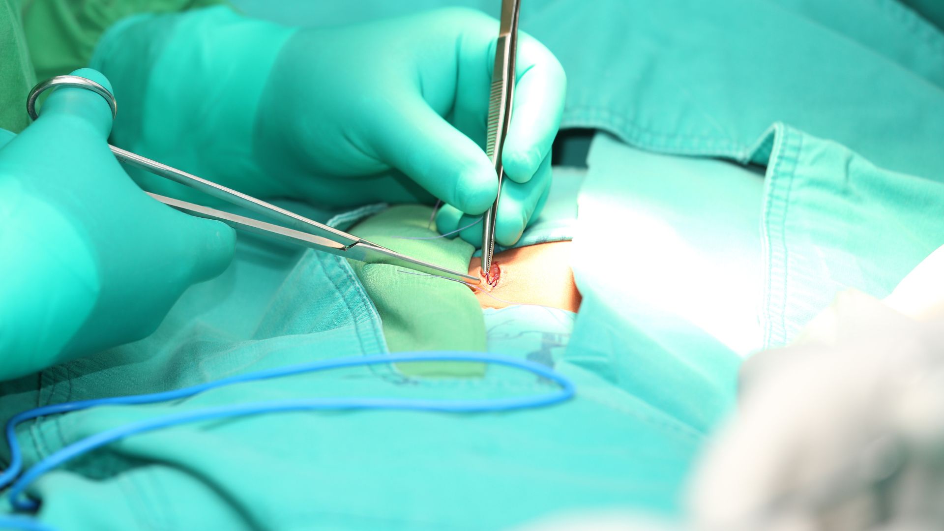 Clinical Absorbable Hemostat Market